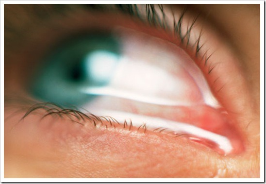4лечение слезоточивости глаз